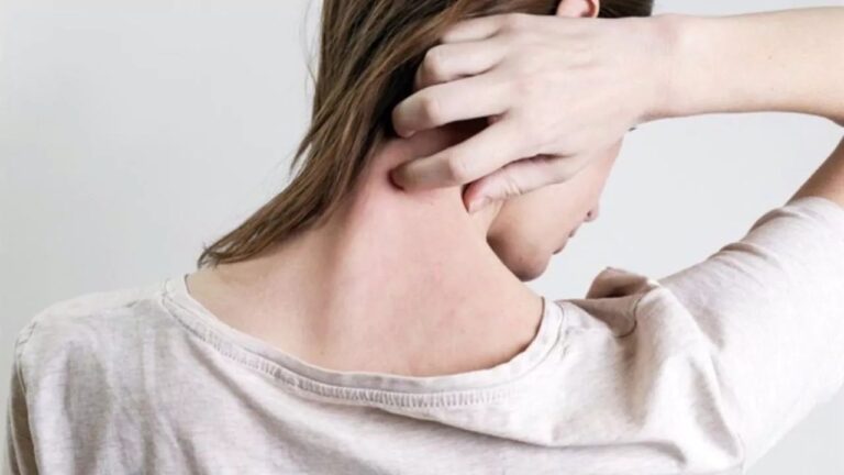 Dermatólogos advierten del impacto que el cambio climático tiene en la salud de la piel